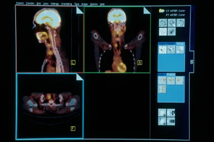 تأثير حقن تخفيض الوزن على فحوصات السرطان والقلق المرتبط بها