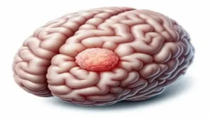تحديد الطفرات الجينية في أورام الدماغ يعزز دقة الجراحة