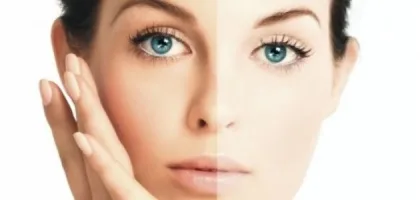 طرق فعالة لتفتيح البشرة بطرق طبيعية وسهلة