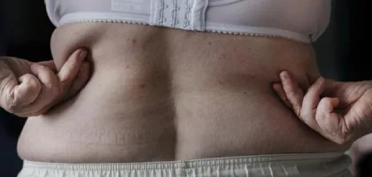 اكتشف أسرار التخلص من دهون الظهر بطرق فعالة