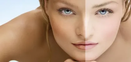 تفتيح البشرة بطرق طبيعية وآمنة