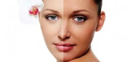 أسباب اسمرار الوجه وأثرها على البشرة