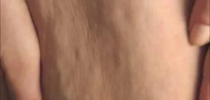 طرق فعالة لإزالة السيلوليت في أسبوع