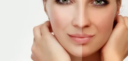 توحيد لون البشرة: استراتيجيات فعالة وآراء خبراء