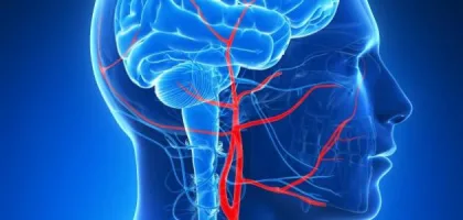 ارتفاع ضغط الدماغ: الأعراض والأسباب وطرق العلاج