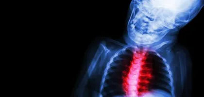 روماتيزم القلب: أسبابه، أعراضه، وعلاجه