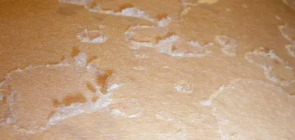 التقشير السطحي بالكريستال والألماس: كل ما تحتاج لمعرفته