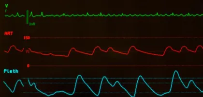 كل ما تحتاج معرفته عن الضغط الشرياني الوسطي