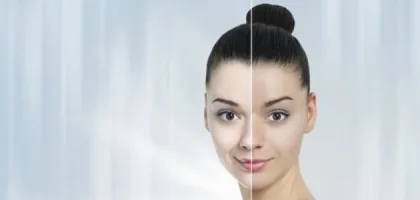 طرق فعالة لتفتيح البشرة بطرق طبيعية