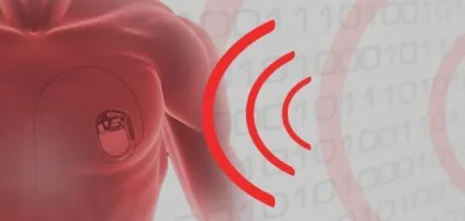 أعراض زيادة كهرباء القلب وكيفية التعامل معها