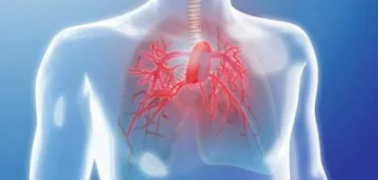 أسباب ارتفاع ضغط الدم الرئوي وأعراضه وتأثيراته