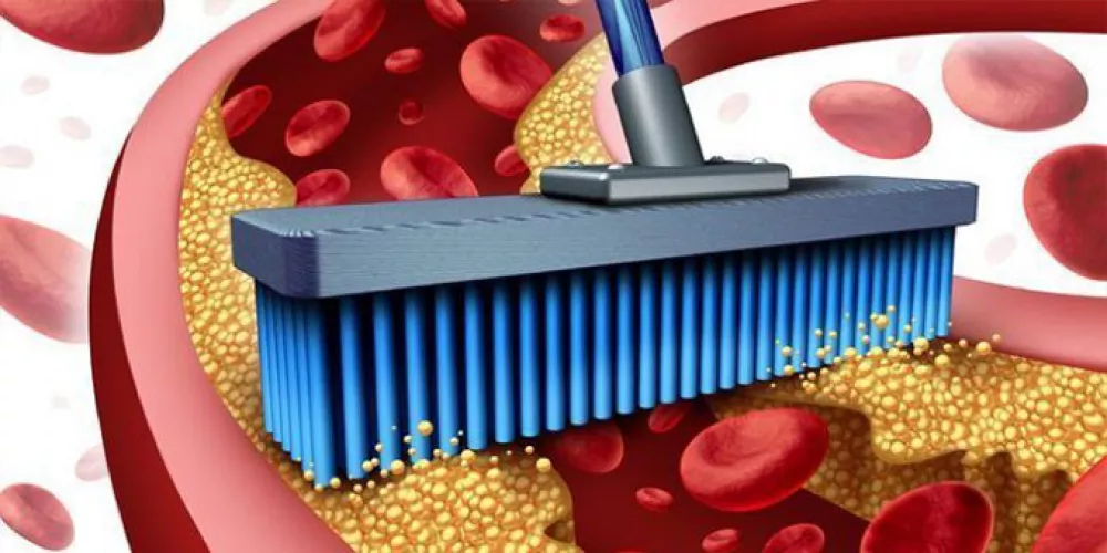 كيف تنظف الشرايين من الكوليسترول طبيعيا؟