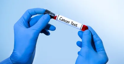 4 طرق لتقليل خطر الإصابة بالسرطان لدى الشباب