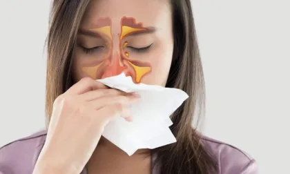 أفضل طرق علاج الحساسية الموسمية