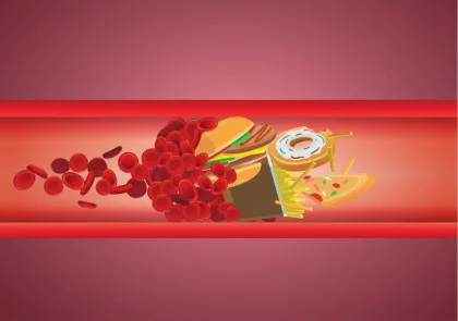 ارتفاع الكوليسترول وضغط الدم عند الشباب والاطفال.. الأسباب والوقاية