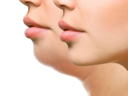 طرق سهلة للتخلص من الذقن المزدوج اللغلوغ