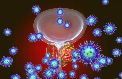 أعراض سرطان البروستاتا وطرق علاجه