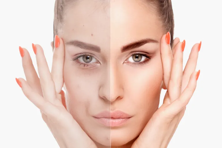 كيف تمنع شيخوخة البشرة المبكرة؟.. دور الكولاجين والأغذية